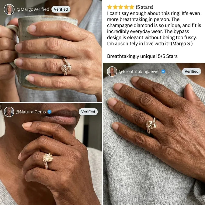 The Vintage Champagne Oval Ring — Ergonomic Bypass Fit for Swollen Knuckles & Everyday Comfort
